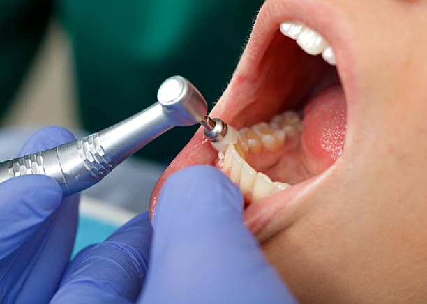 Best Periodontal (Gum) Disease Treatment  in Fort Bragg, CA